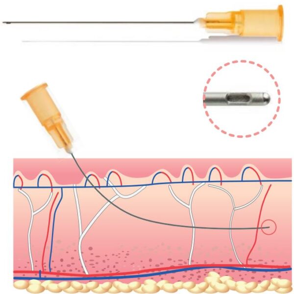 Cannula